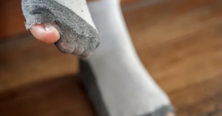 До чого сняться діряві носки